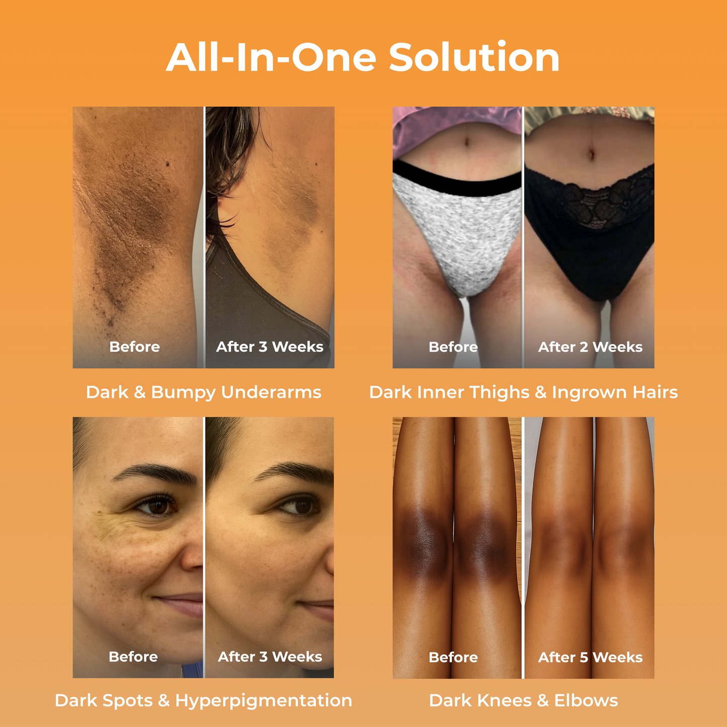 LightSkn™ Turmeric & Kojic Acid Beauty Bar
