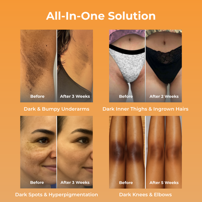 LightSkn™ Turmeric & Kojic Acid Beauty Bar